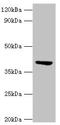 ST3 Beta-Galactoside Alpha-2,3-Sialyltransferase 3 antibody, orb241555, Biorbyt, Western Blot image 