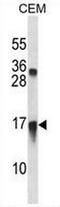 C-X-C Motif Chemokine Ligand 11 antibody, AP51143PU-N, Origene, Western Blot image 