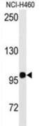 Homeodomain Interacting Protein Kinase 2 antibody, abx033461, Abbexa, Western Blot image 