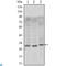 CD69 Molecule antibody, LS-C814004, Lifespan Biosciences, Western Blot image 