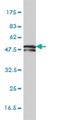 Keratin 81 antibody, H00003887-M01, Novus Biologicals, Western Blot image 