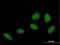 Zinc Finger Protein 549 antibody, H00256051-B01P, Novus Biologicals, Immunocytochemistry image 