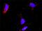 E2F Transcription Factor 2 antibody, H00001870-D01P, Novus Biologicals, Proximity Ligation Assay image 