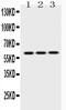 Keratin 14 antibody, A01432, Boster Biological Technology, Western Blot image 