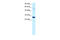 Poly(ADP-Ribose) Polymerase 1 antibody, 27-939, ProSci, Enzyme Linked Immunosorbent Assay image 