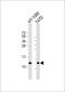 Signal Peptidase Complex Subunit 1 antibody, M12522, Boster Biological Technology, Western Blot image 