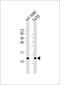 Signal peptidase complex subunit 1 antibody, M12522, Boster Biological Technology, Western Blot image 