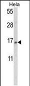 Small Nuclear Ribonucleoprotein D2 Polypeptide antibody, PA5-49594, Invitrogen Antibodies, Western Blot image 