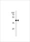 Transcription Factor AP-2 Delta antibody, LS-C204033, Lifespan Biosciences, Western Blot image 