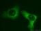 Eukaryotic Translation Initiation Factor 3 Subunit M antibody, 11423-1-AP, Proteintech Group, Immunofluorescence image 