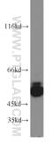 Cdc42 Guanine Nucleotide Exchange Factor 9 antibody, 20042-1-AP, Proteintech Group, Western Blot image 