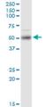 ETS Variant 1 antibody, H00002115-M02, Novus Biologicals, Western Blot image 