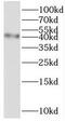 Transmembrane Protein 38B antibody, FNab08781, FineTest, Western Blot image 