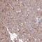 TRNA Methyltransferase 2 Homolog B antibody, FNab09006, FineTest, Immunohistochemistry paraffin image 