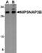 Nipsnap Homolog 3B antibody, A17432, Boster Biological Technology, Western Blot image 