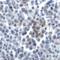 TNF Superfamily Member 14 antibody, RF16064, ProSci, Immunohistochemistry paraffin image 