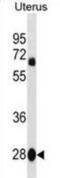 Vestigial Like Family Member 4 antibody, abx031040, Abbexa, Western Blot image 