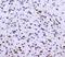 RAD51 Recombinase antibody, A00088, Boster Biological Technology, Immunohistochemistry paraffin image 