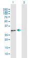 Enkurin, TRPC Channel Interacting Protein antibody, MA5-24581, Invitrogen Antibodies, Western Blot image 