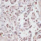 Dyskerin Pseudouridine Synthase 1 antibody, 14-697, ProSci, Immunohistochemistry paraffin image 