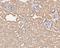 Serpin Family C Member 1 antibody, NBP2-80391, Novus Biologicals, Immunohistochemistry paraffin image 
