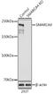 SWI/SNF Related, Matrix Associated, Actin Dependent Regulator Of Chromatin, Subfamily A, Member 4 antibody, GTX32478, GeneTex, Western Blot image 