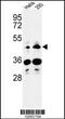 Heparan Sulfate-Glucosamine 3-Sulfotransferase 2 antibody, 63-982, ProSci, Western Blot image 
