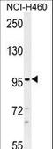 Transient Receptor Potential Cation Channel Subfamily M Member 8 antibody, LS-C160236, Lifespan Biosciences, Western Blot image 