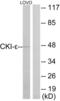 Casein Kinase 1 Epsilon antibody, LS-B7056, Lifespan Biosciences, Western Blot image 