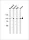 BCL6 Transcription Repressor antibody, M00142, Boster Biological Technology, Western Blot image 