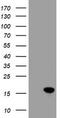 Cellular Retinoic Acid Binding Protein 2 antibody, TA800069BM, Origene, Western Blot image 