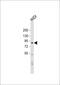 Sushi Domain Containing 2 antibody, 56-819, ProSci, Western Blot image 