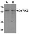 Dual Specificity Tyrosine Phosphorylation Regulated Kinase 2 antibody, A03498, Boster Biological Technology, Western Blot image 