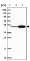 Activating Transcription Factor 7 Interacting Protein 2 antibody, PA5-59489, Invitrogen Antibodies, Western Blot image 