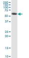 Lysophosphatidylcholine Acyltransferase 2 antibody, H00054947-B01P, Novus Biologicals, Western Blot image 