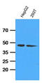 Adenosine Kinase antibody, LS-B6272, Lifespan Biosciences, Western Blot image 