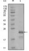 Heart And Neural Crest Derivatives Expressed 1 antibody, abx011691, Abbexa, Enzyme Linked Immunosorbent Assay image 