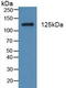 Platelet Derived Growth Factor Receptor Alpha antibody, LS-C710971, Lifespan Biosciences, Western Blot image 