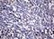 NME/NM23 Nucleoside Diphosphate Kinase 1 antibody, LS-C175694, Lifespan Biosciences, Immunohistochemistry paraffin image 