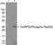 Heterogeneous Nuclear Ribonucleoprotein D antibody, GTX55319, GeneTex, Western Blot image 