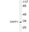 Dual Adaptor Of Phosphotyrosine And 3-Phosphoinositides 1 antibody, LS-C176636, Lifespan Biosciences, Western Blot image 