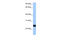 Chondroitin Polymerizing Factor 2 antibody, 30-461, ProSci, Western Blot image 