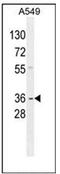 G Protein Subunit Alpha Transducin 3 antibody, AP51877PU-N, Origene, Western Blot image 