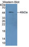 Adhesion Regulating Molecule 1 antibody, LS-C725354, Lifespan Biosciences, Western Blot image 