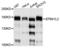 Erythrocyte Membrane Protein Band 4.1 Like 2 antibody, LS-C410635, Lifespan Biosciences, Western Blot image 