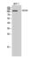 Glutamyl Aminopeptidase antibody, PA5-51135, Invitrogen Antibodies, Western Blot image 