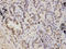 Proteasome 26S Subunit, Non-ATPase 2 antibody, A06642-1, Boster Biological Technology, Immunohistochemistry frozen image 