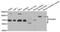 Interferon Gamma Receptor 1 antibody, A5748, ABclonal Technology, Western Blot image 