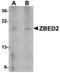 Zinc Finger BED-Type Containing 2 antibody, PA5-20723, Invitrogen Antibodies, Western Blot image 