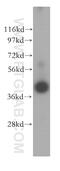 Interleukin 2 Receptor Subunit Gamma antibody, 11409-1-AP, Proteintech Group, Western Blot image 